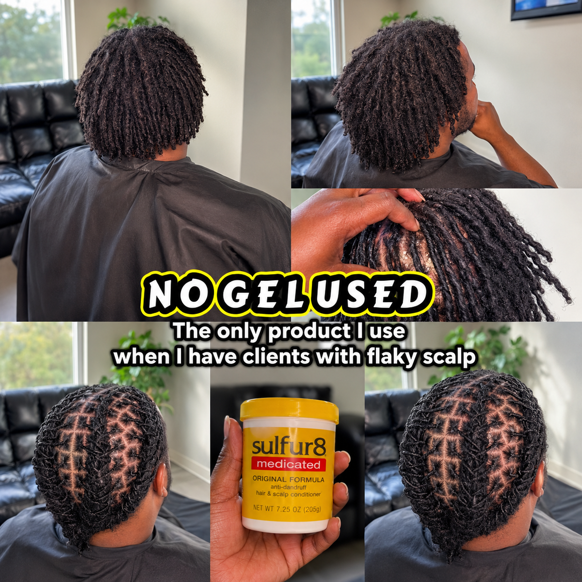 Sulfur8 Loc Twist & Braid Butter used for locs and twists with flaky scalp before-and-after hairstyle results